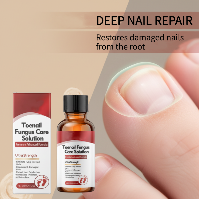 Offre Noël limitée : -50 % sur l’Essence réparatrice pour ongles abîmés — des ongles plus forts et revitalisés