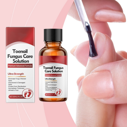 Offre Noël limitée : -50 % sur l’Essence réparatrice pour ongles abîmés — des ongles plus forts et revitalisés